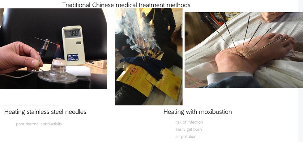 Silver Needle Thermal Conduction Therapy Instrument