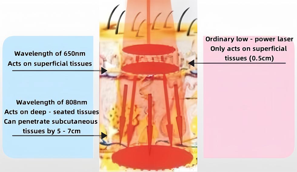 Semiconductor Laser Therapeutic Apparatus