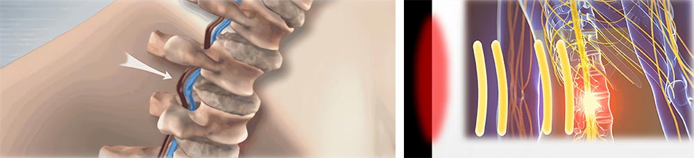 Electric Traction Bed