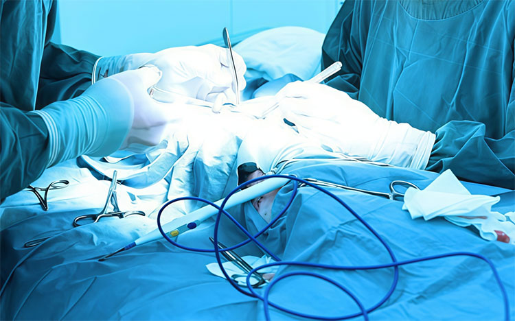 Disposable Electrosurgical Knife China