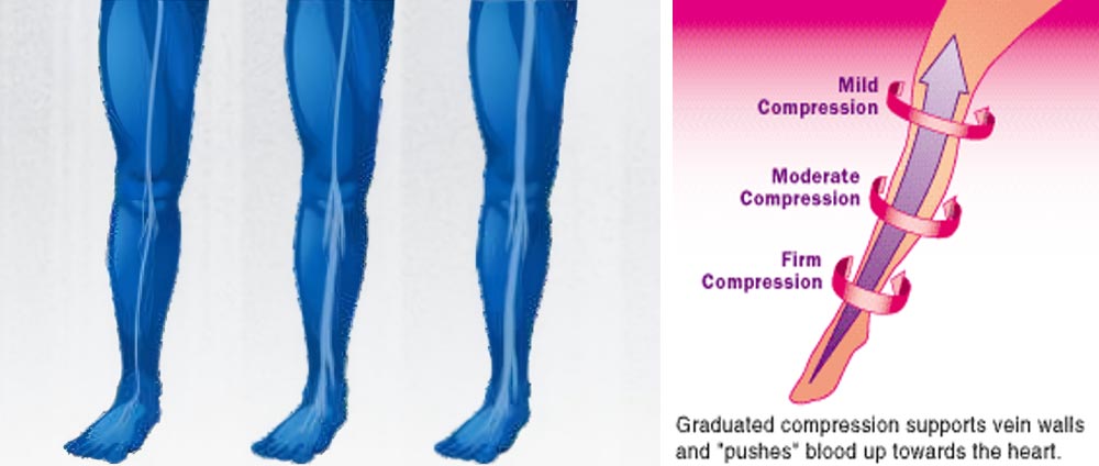 Air Compression Therapy system