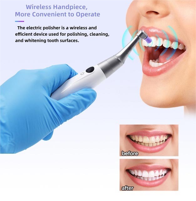 Dental Polisher