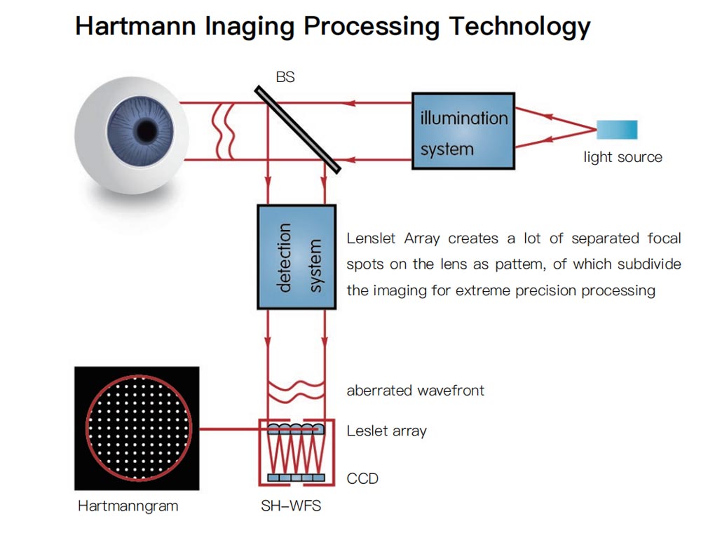 Optical Autorefractor