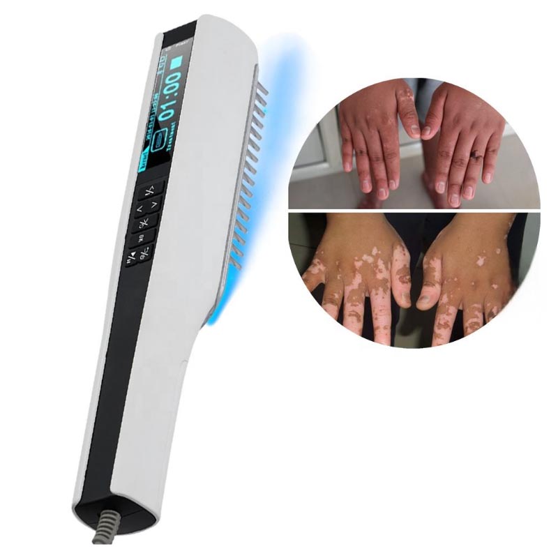 جهاز العلاج الضوئي بالأشعة فوق البنفسجية